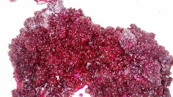 селедка под шубой в желе